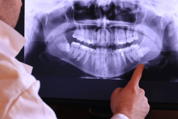 Best Emergency Wisdom Teeth Removal in El Paso, TX