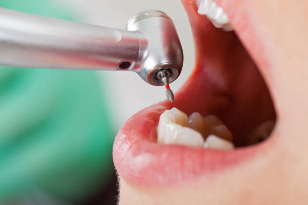 Best Pediatric Emergency Dentist in El Paso, TX